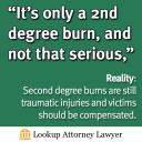 Second degree burns are still traumatic injuries and victims should be compensated.